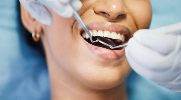 Best Emergency Treatment for Dental Infections or Abscesses in Burlington, NC